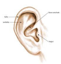 opération chirurgie oreilles décollées
